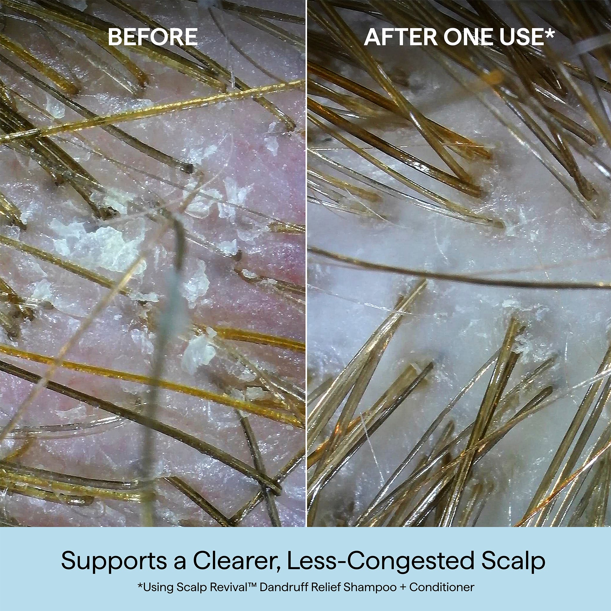 Scalp Revival™ Dandruff Relief Shampoo with Charcoal + 3% Salicylic Acid - Briogeo